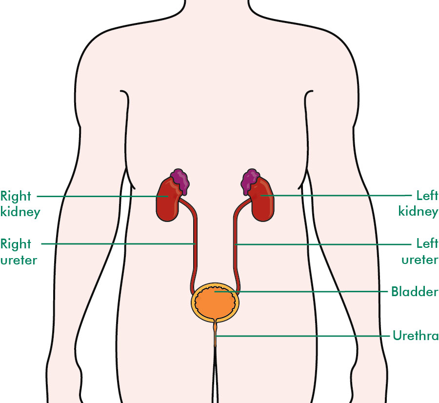 Nephrostomy - Information And Support