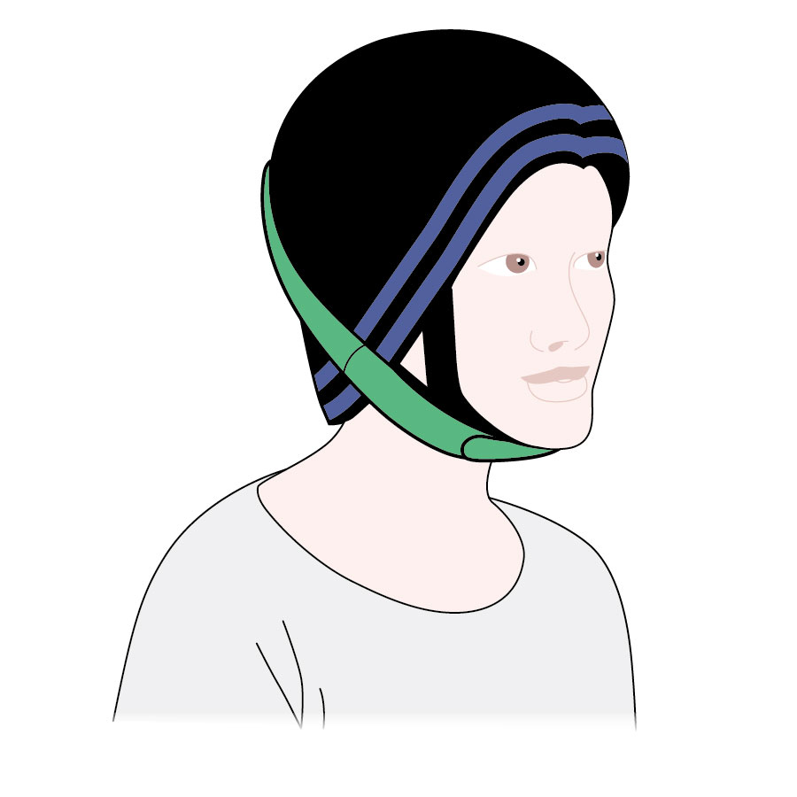 Scalp cooling Information and support Macmillan Cancer Support