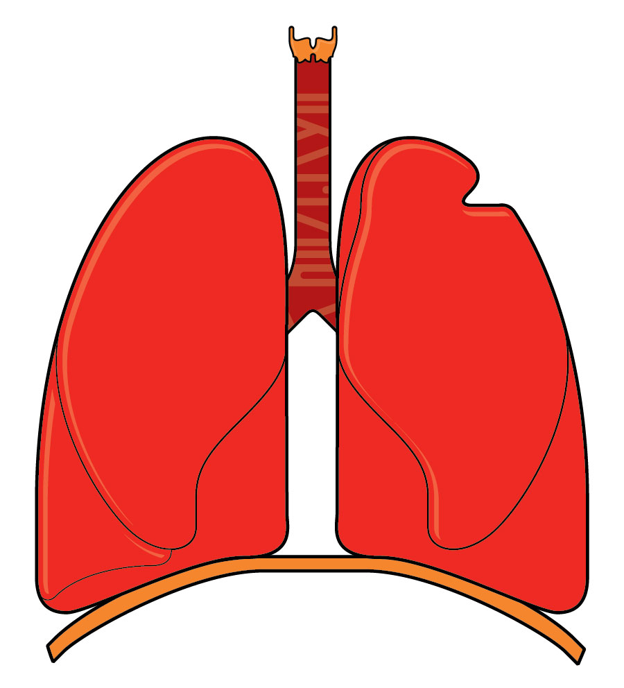 Surgery for nonsmall cell lung cancer Information and support