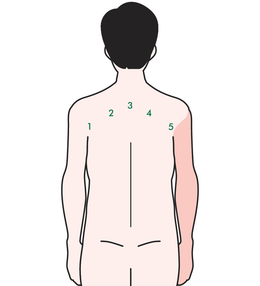 Lymphatic drainage Information and support Macmillan Cancer Support