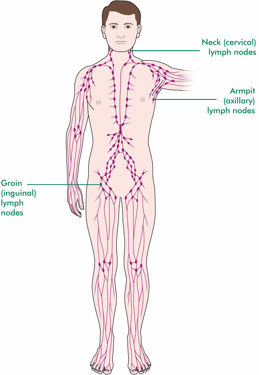 Lymphomas and the lymphatic system - Cancer information for teens and ...