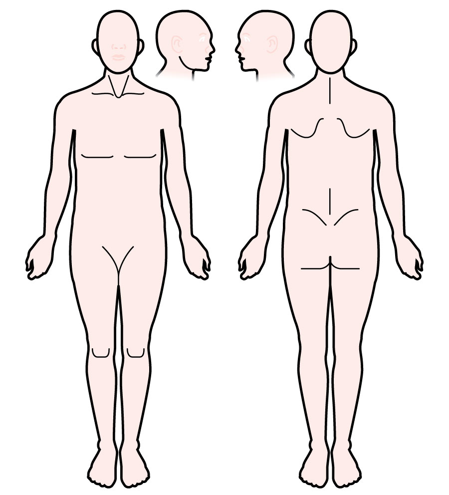 Body Chart Assessment Form