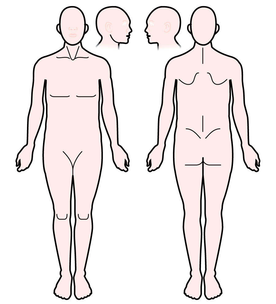 Where Does It Hurt Chart