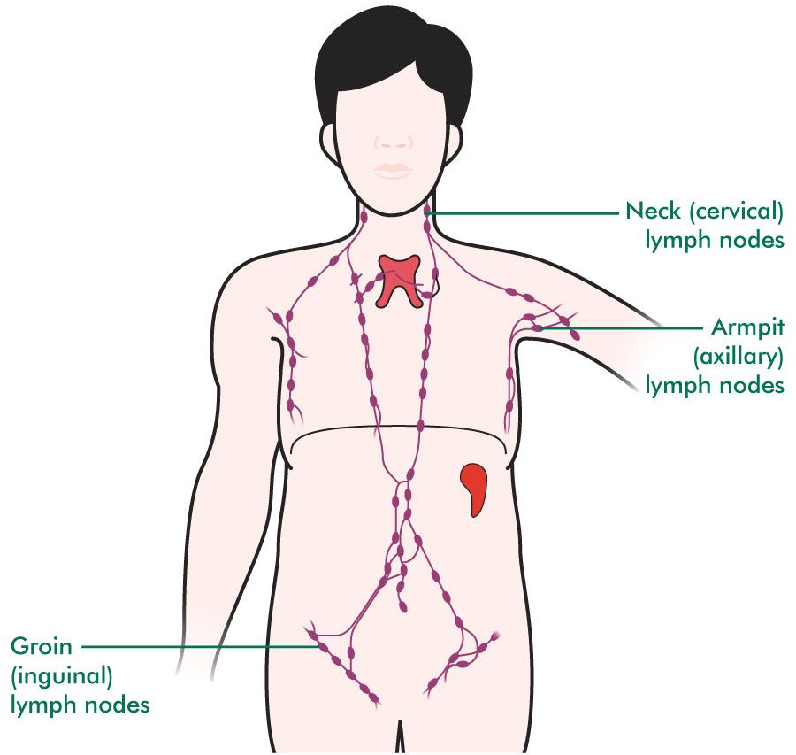 Mediastinal Large B Cell Lymphoma Understanding Macmillan Cancer