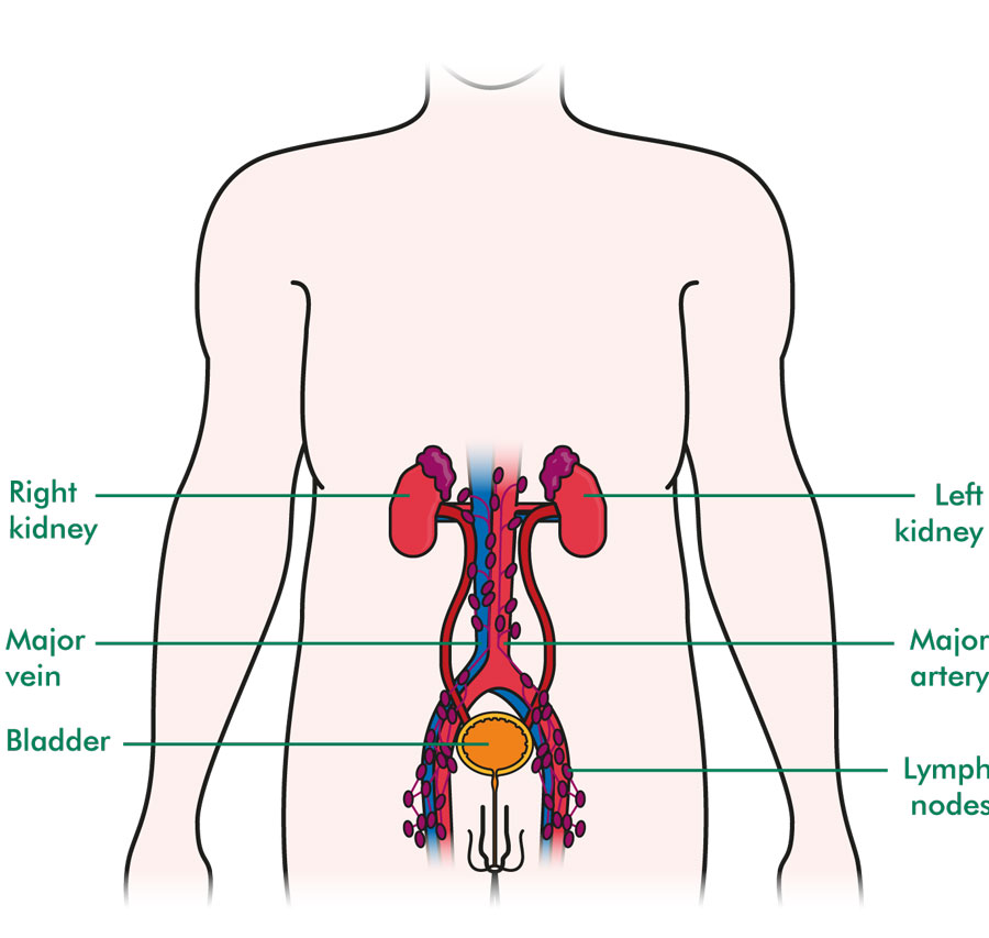 The lymphatic system - Understanding cancer - Macmillan Cancer Support