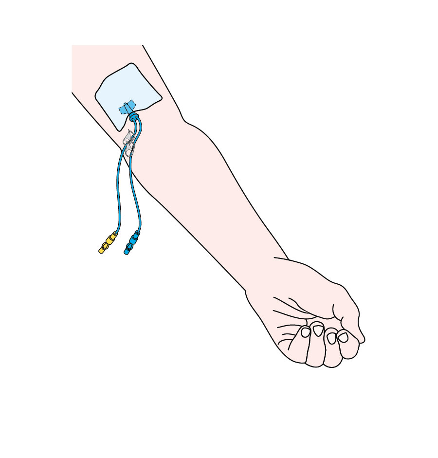 20+ New For Drawing Blood From Picc Line With Syringe | The Campbells