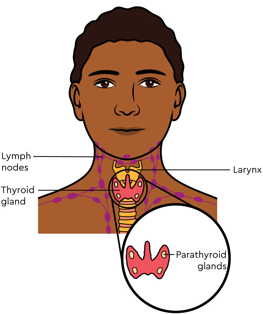 A neck, showing the 4 parathyroid glands, attached behind the thyroid gland. The thyroid is in the lower middle part of the neck.