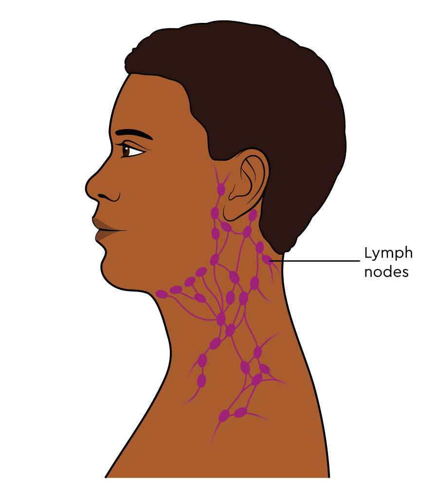 Lymph Nodes In Neck Diagram
