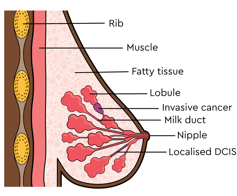 The side view of the breast