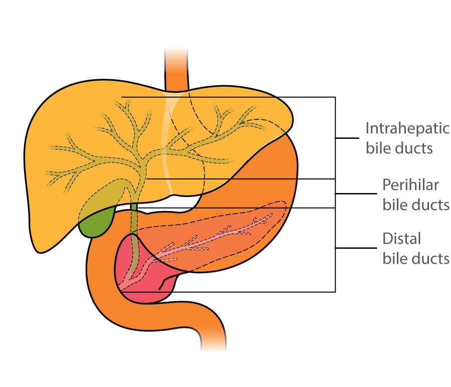 The intrahepatic bile ducts are inside the liver. The perihilar bile ducts are just under the liver. The distal bile ducts join the small bowel.
