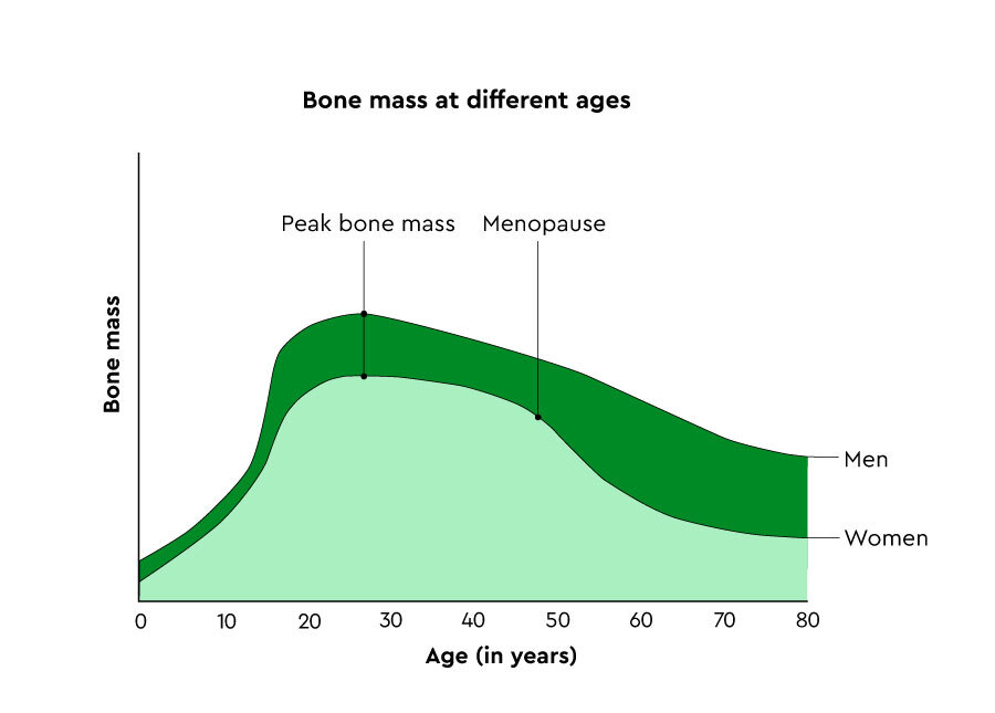 MACIG043 Bone mass chart