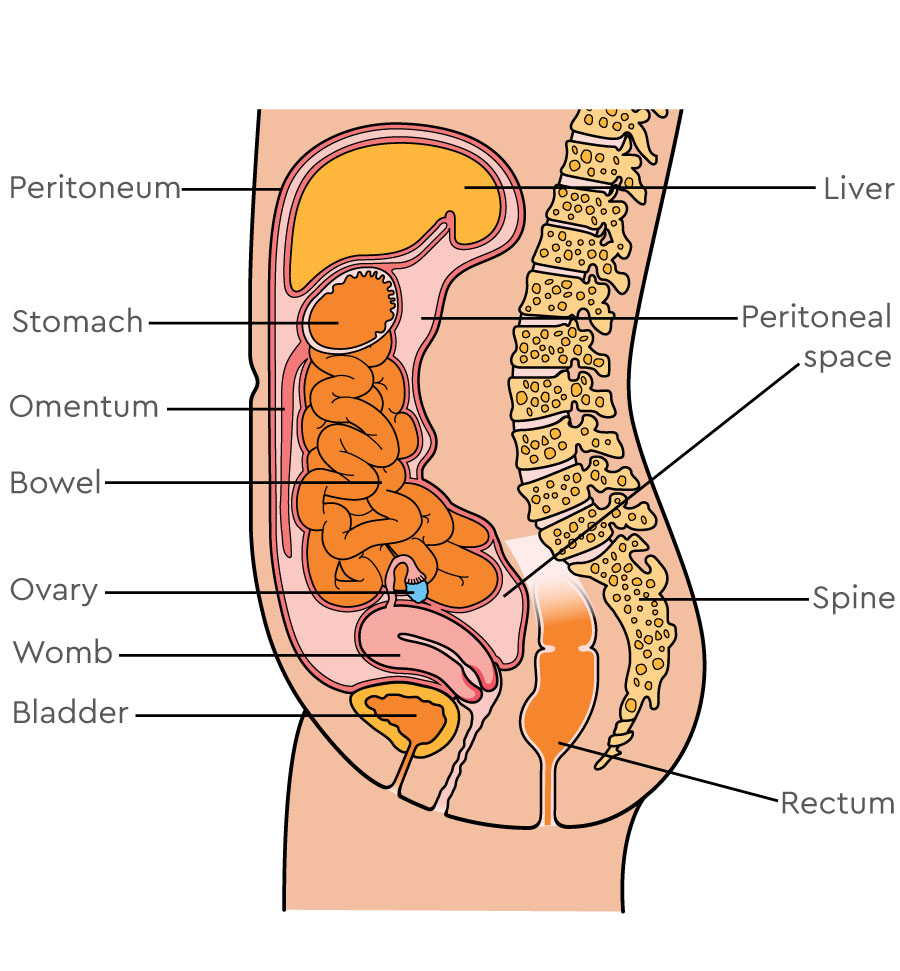 Medical illustration of the female reproductive organs and associated lymphatic drainage pathways. Para-aortic lymph nodes above the uterus and pelvic lymph nodes alongside the uterus, ovaries, and vagina are highlighted.