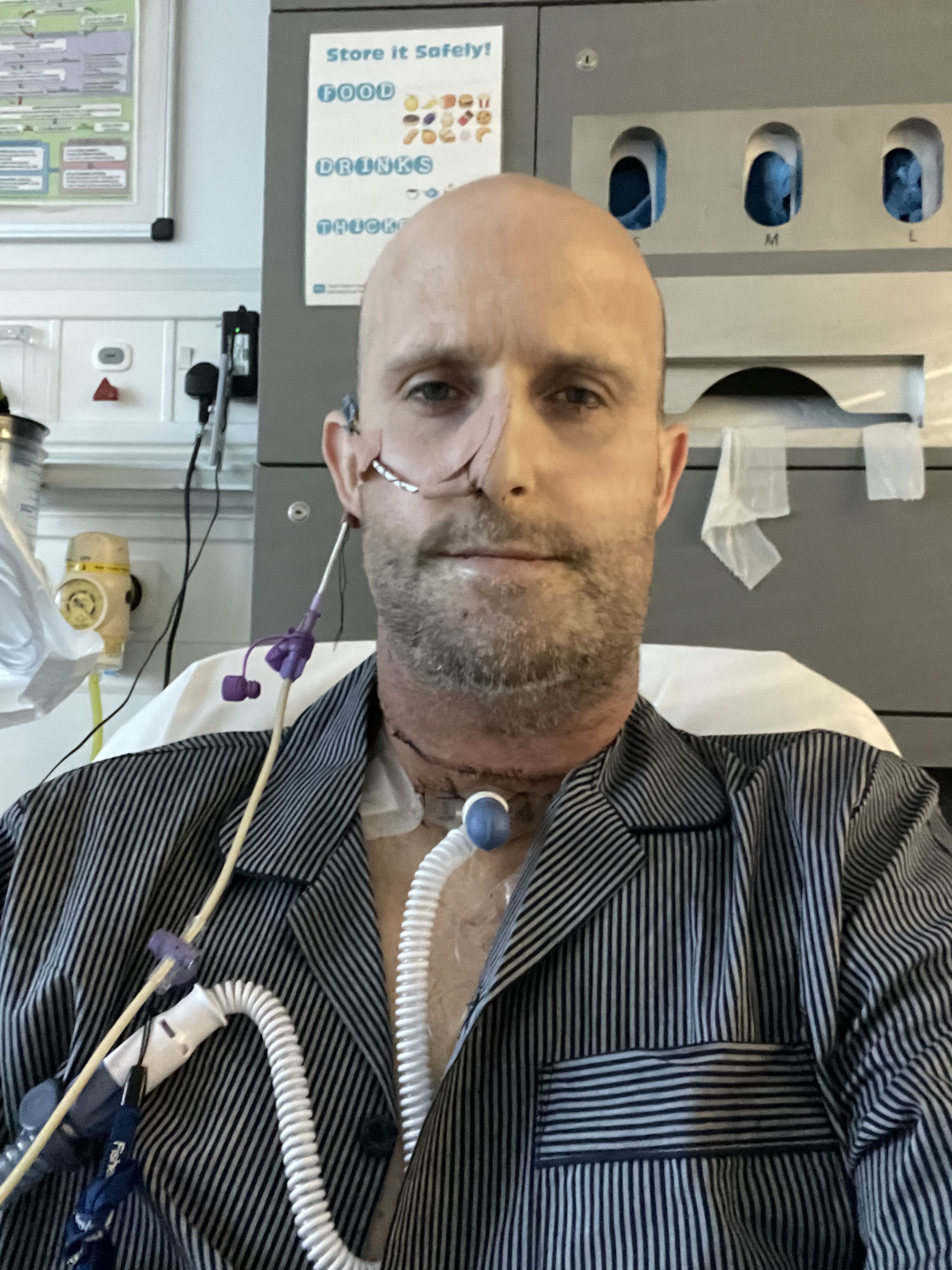 A photo of Shaun in a hospital bed wearing a striped gown, with oxygen and medical tubes attached, in a clinical room featuring medical equipment and a safety poster.