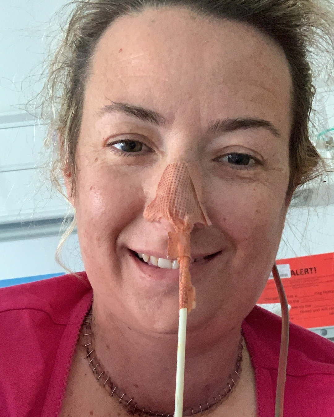 A photo of Lisa in a medical setting wearing a pink top and chain necklace, with a nasal tube secured by adhesive tape.