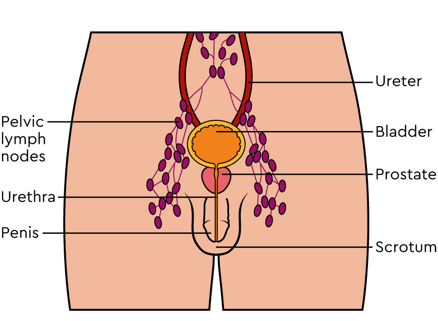 The illustration shows the lower body from the front. It shows the penis, bladder, scrotum, and prostate. It shows the lymph nodes around the bladder.