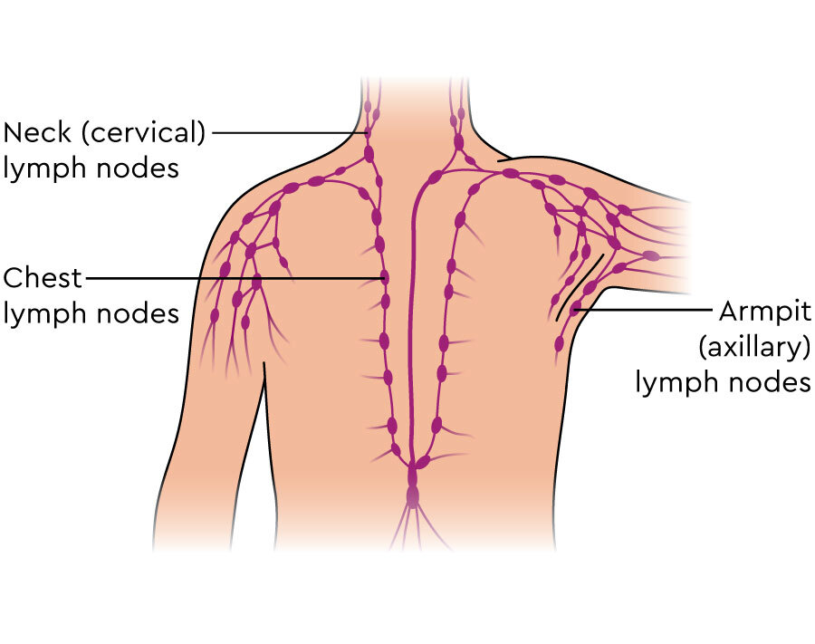 Diagram of the network of lymph nodes in the neck, armpit and chest.