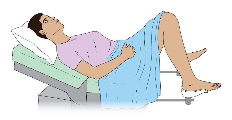 A person lying on a short padded bench, ready to have a vulval examination.
