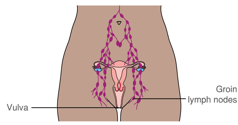 https://www.macmillan.org.uk/dfsmedia/1a6f23537f7f4519bb0cf14c45b2a629/4227-50034/macd108-fem-pelvic-lymph-nodes-labelled-20171016