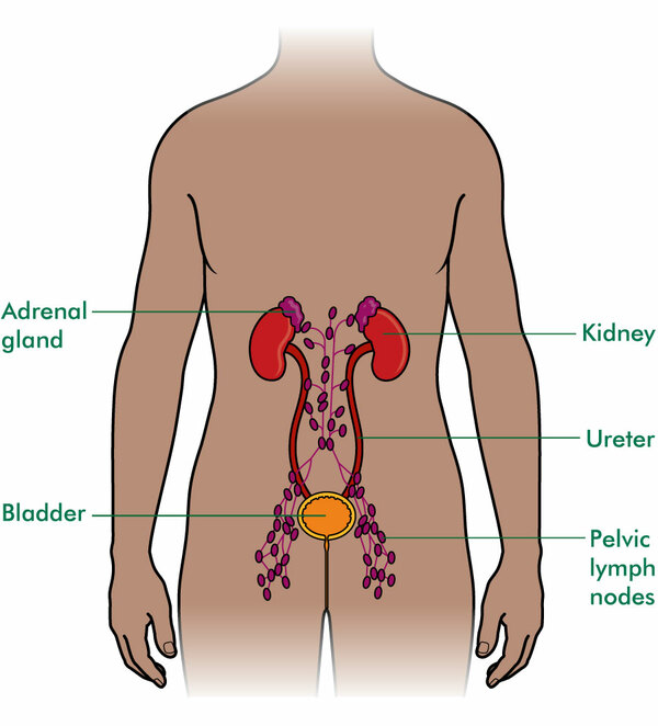 area of mesothelioma