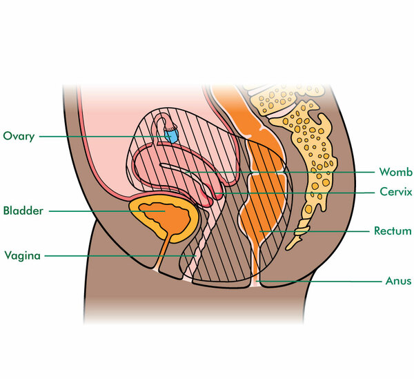 types of pelvic exenteration for women macmillan cancer support