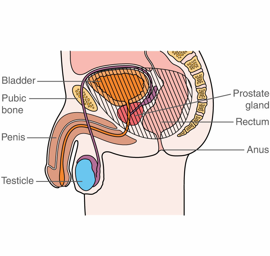 types of pelvic exenteration for men macmillan cancer support